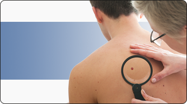 Skin Cancer - Dermatology service Greenville, NC