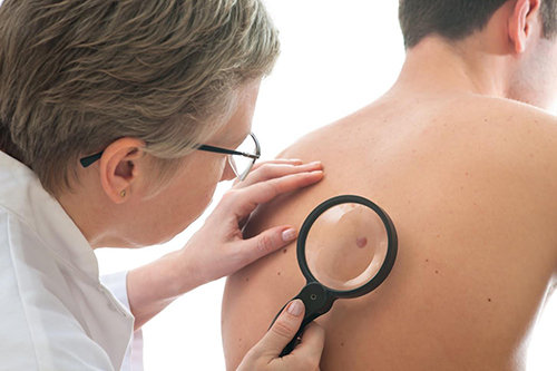 Examining Back Skin